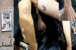 ارث پدری این پسر را وحشی کرد/ همه را گاز گرفت و پدرش را کشت 