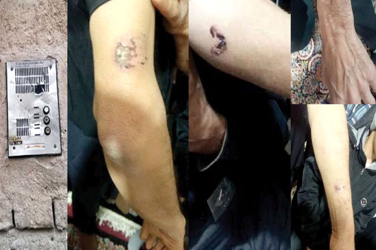 ارث پدری این پسر را وحشی کرد/ همه را گاز گرفت و پدرش را کشت 