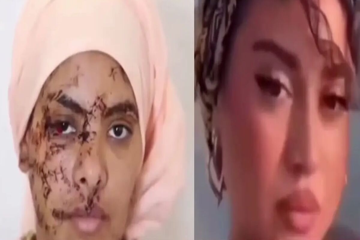 130 بخیه بر صورت و دستان زن جوان/ شوهر سابقش صورت زیبای او را با چاقو خط خطی کرد/ ویدئو+18