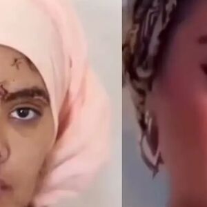 130 بخیه بر صورت و دستان زن جوان/ شوهر سابقش صورت زیبای او را با چاقو خط خطی کرد/ ویدئو+18