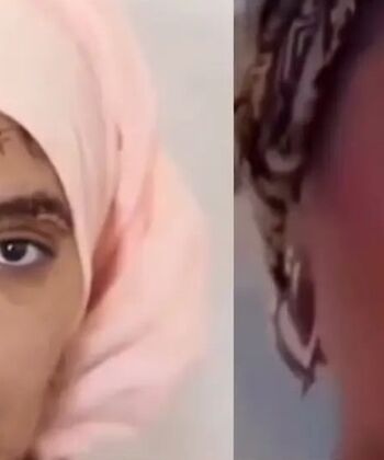 130 بخیه بر صورت و دستان زن جوان/ شوهر سابقش صورت زیبای او را با چاقو خط خطی کرد/ ویدئو+18