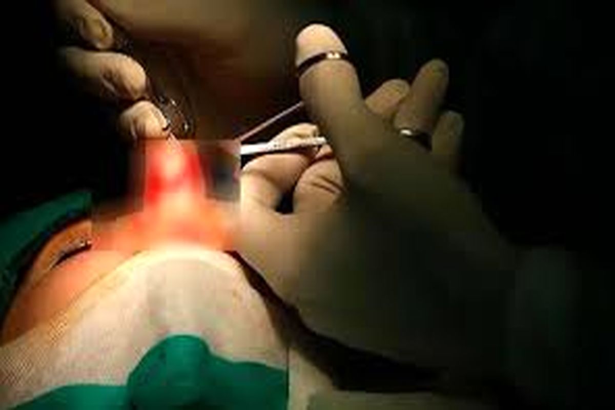 زن جوان هنگام عمل جراحی بینی جان باخت