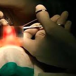 زن جوان هنگام عمل جراحی بینی جان باخت