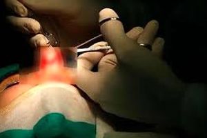 زن جوان هنگام عمل جراحی بینی جان باخت