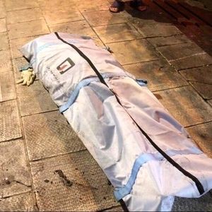 شناسایی هویت جسدی که بخشی ازآن توسط حیوانات خورده شده بود