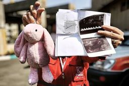 برگه سونوگرافی و عروسک صورتی؛ روایت تلخ از حمله