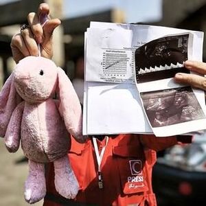 برگه سونوگرافی و عروسک صورتی؛ روایت تلخ از حمله