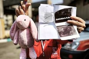 برگه سونوگرافی و عروسک صورتی؛ روایت تلخ از حمله