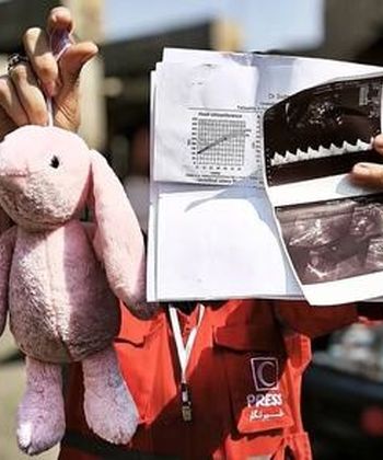 برگه سونوگرافی و عروسک صورتی؛ روایت تلخ از حمله