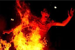 آتش بازی پسر نوجوان در خیابان پیروزی باعث سوختن دوستش شد