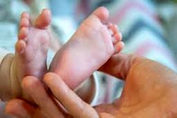 تولد حیرت انگیز دختر عجیب الخلقه/ با خنده هایش دنیا را شیفته خود کرد