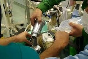گیر کردن دست کودک تهرانی در چرخ گوشت/ ویدئو