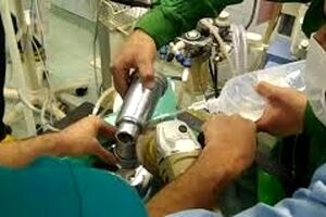گیر کردن دست کودک تهرانی در چرخ گوشت/ ویدئو