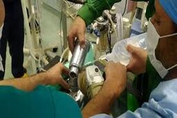 گیر کردن دست کودک تهرانی در چرخ گوشت/ ویدئو