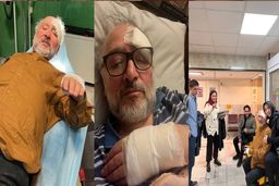 سیدمحمد ابطحی مجروح شد: ۱۰ بخیه روی ابرو و ترک خوردن قفسه سینه 