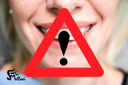 خطرات وحشتناک در عدم انجام ارتودنسی دندان