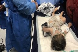 چرخ گوشت دست کودک ۲ ساله را بلعید 