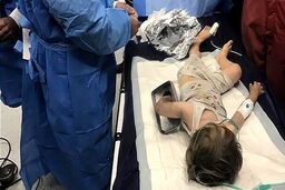 چرخ گوشت دست کودک ۲ ساله را بلعید 