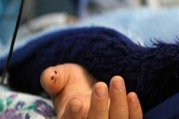 فوت مشکوک کودک ایلامی؛ ورود دادستان به پرونده