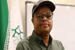 دردهای ناگفته از یک قربانی اسیدپاشی 