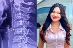 ماساژ گردن، خواننده تایلندی را به کشتن داد