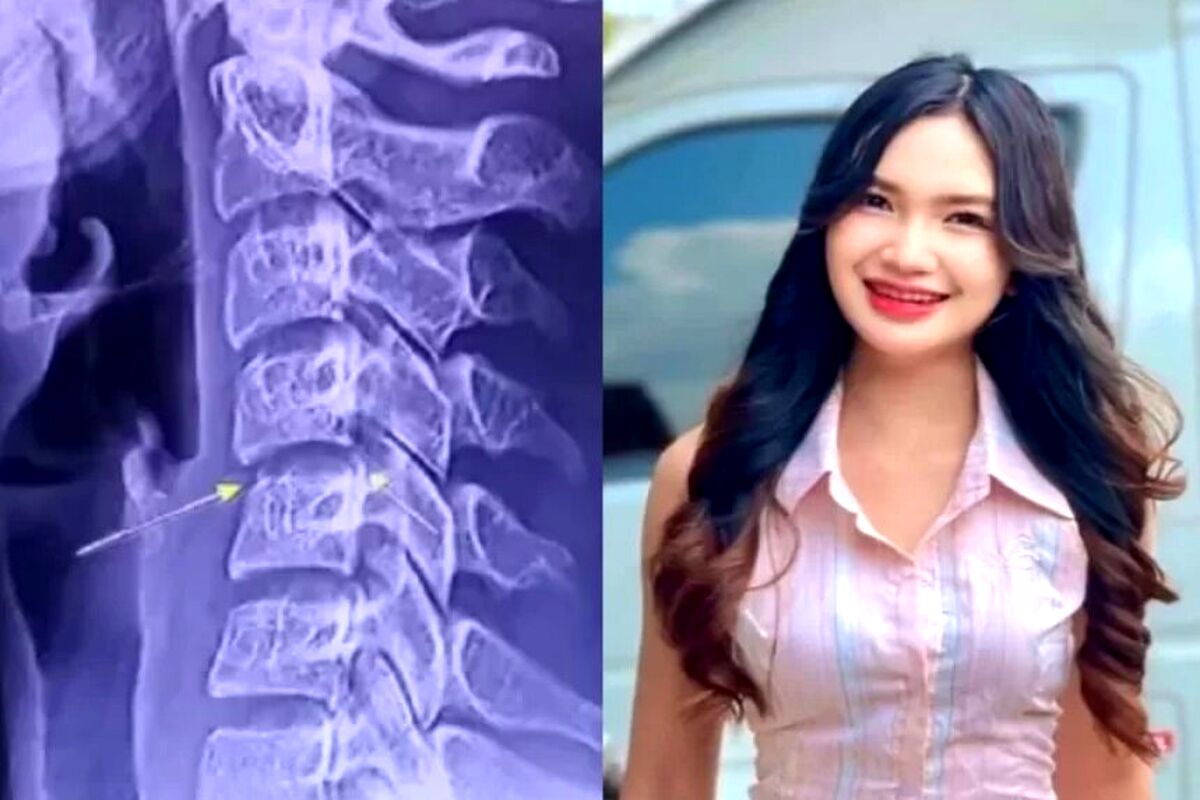 ماساژ گردن، خواننده تایلندی را به کشتن داد