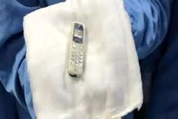 تلفن همراه بعد از شش سال از معده یک زندانی خارج شد