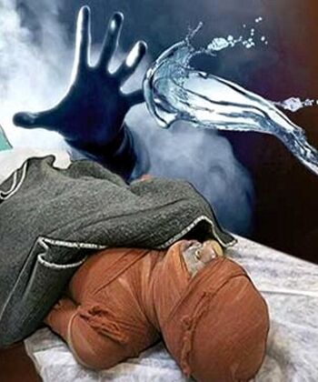 اسیدپاشی مرگبار به برادر
