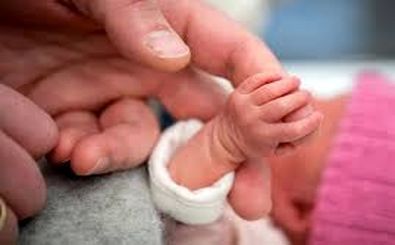 تولد نوزاد عجیب‌الخلقه‌ای با یک سر اضافه روی شکم