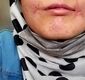 مرد مشهدی لب‌های زن ۱۸ ساله‌اش را دوخت/ فائزه به کلانتری پناه برد