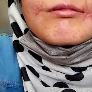 مرد مشهدی لب‌های زن ۱۸ ساله‌اش را دوخت/ فائزه به کلانتری پناه برد