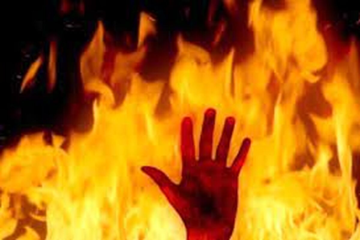 مرد تهرانی زنش را زنده زنده سوزاند