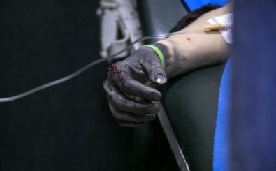 انفجار نارنجک دستی انگشتان پاکبان ۲۸ ساله را قطع کرد